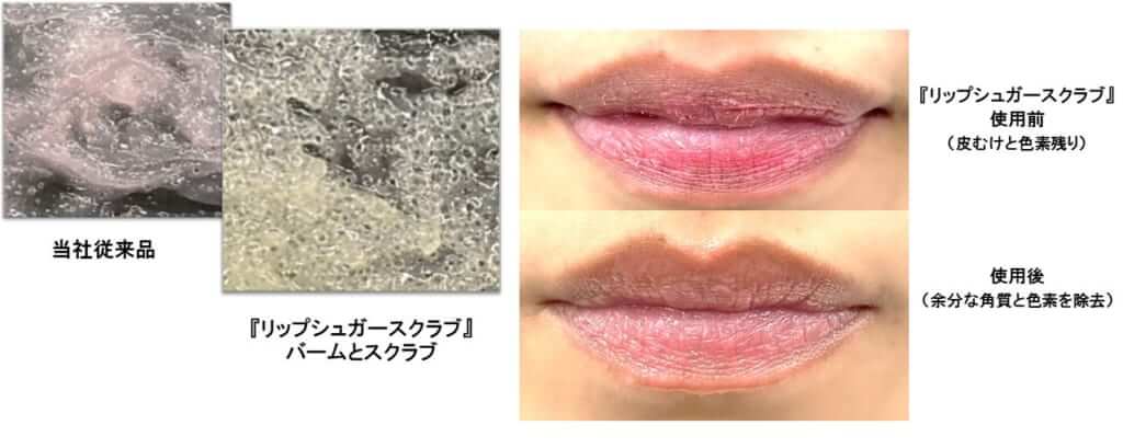 唇専用ブランド「CHOOSY(チューシー)」のスペシャルケアでぷるぷるの唇に♡｜itSnapマガジン